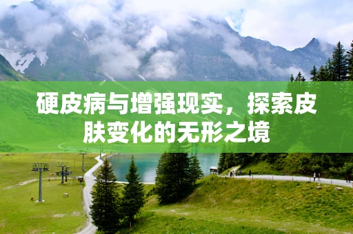 硬皮病与增强现实，探索皮肤变化的无形之境